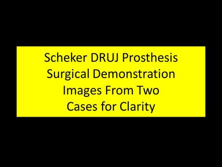 Scheker DRUJ Prosthesis Surgical Demonstration Images From Two Cases for Clarity.