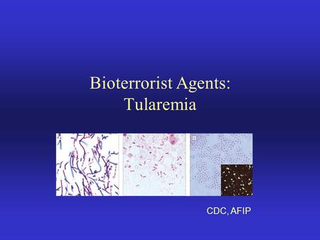 Bioterrorist Agents: Tularemia