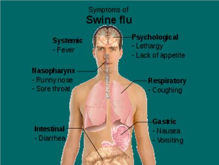 FREQUENTLY ASKED QUESTIONS  What is swine flu? Swine Influenza (swine flu) is a respiratory disease of pigs caused by type a influenza viruses that causes.