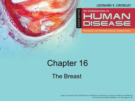 Chapter 16 The Breast.