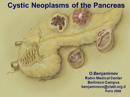 Cystic Neoplasms of the Pancreas