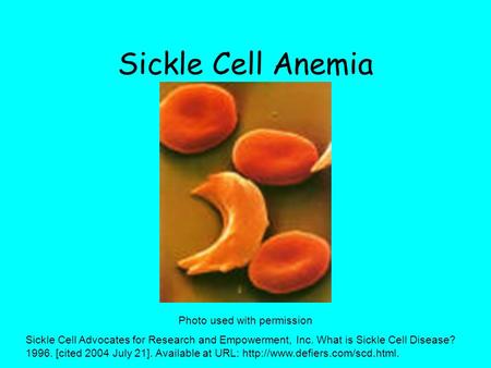 Sickle Cell Anemia Photo used with permission Sickle Cell Advocates for Research and Empowerment, Inc. What is Sickle Cell Disease? 1996. [cited 2004 July.