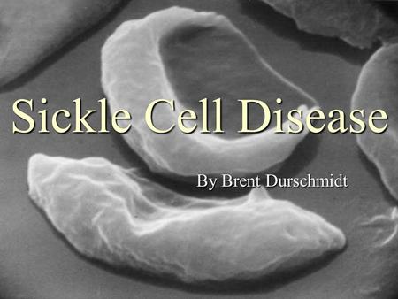 Sickle Cell Disease By Brent Durschmidt. Quick Definition ► It is a disorder of red blood cell production that gives red blood cells a sickle shape during.