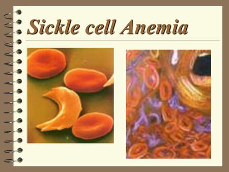Sickle cell Anemia. Background Information 4 Sickle cell anemia is a life threatening disease that is triggered by low hemogoblin levels. According to.