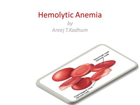 Acquired haemolytic anaemias - ppt download