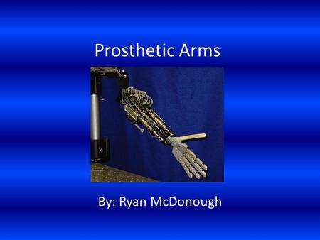Prosthetic Arms By: Ryan McDonough. History of Prosthetic Arms Before this mainly prosthetic hands were made out of iron But in 1508 a knight had two.