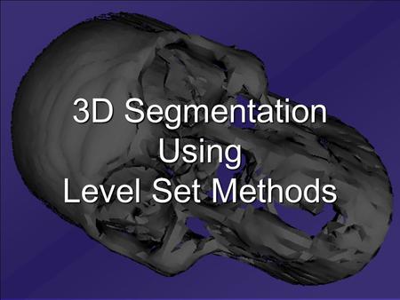3D Segmentation Using Level Set Methods. Heriot-Watt University, Edinburgh, Scotland Zsolt Husz Mokhled Al-TarawnehÍzzet Canarslan University of Newcastle.
