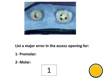 1 Shift List a major error in the access opening for: 1- Premolar: 2- Molar: