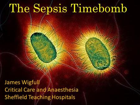 Copyright Wigfull 2013 The Sepsis Timebomb James Wigfull Critical Care and Anaesthesia Sheffield Teaching Hospitals.