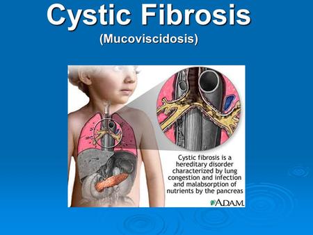 Cystic Fibrosis (Mucoviscidosis)