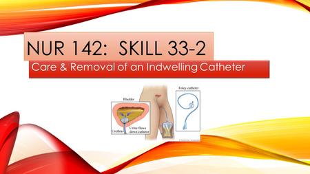 Care & Removal of an Indwelling Catheter
