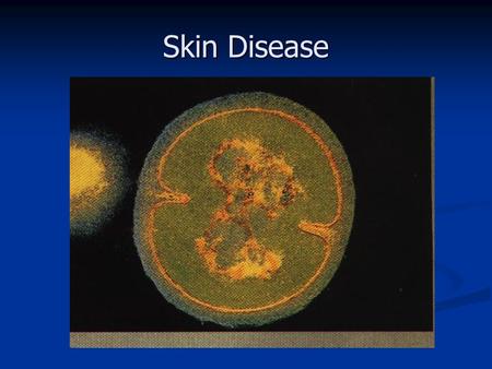 Skin Disease. I. Skin A. Functions 1. 2. 2. 3. 3. 4. 4.