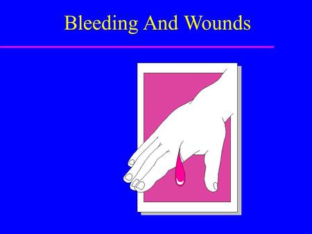 Bleeding And Wounds. Sources of External Bleeding u Arteries u Veins u Capillaries.