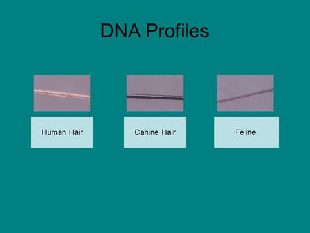 DNA Profiles Human HairFelineCanine Hair. Annabel Farqua Click picture to view DNA profile.