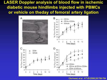LASER Doppler analysis of blood flow in ischemic diabetic mouse hindlimbs injected with PBMCs or vehicle on theday of femoral artery ligation Ola Awad,