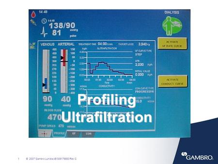 Profiling Ultrafiltration