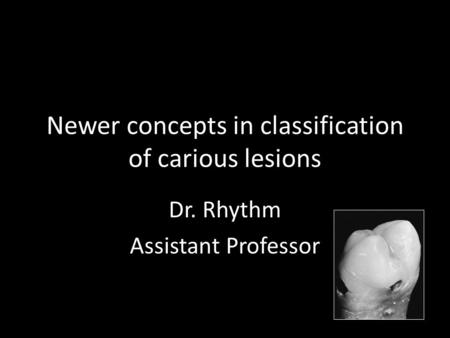 Newer concepts in classification of carious lesions