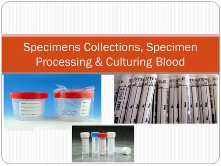 Specimens Collections, Specimen Processing & Culturing Blood