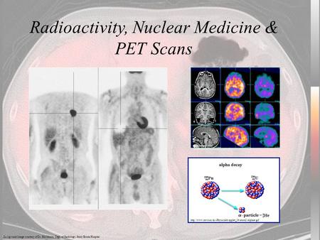 Radioactivity, Nuclear Medicine & PET Scans Background Image courtesy of Dr. Bill Moore, Dept. of Radiology, Stony Brook Hospital  studholme.net/research/ipag/mrdspect/mrspect3.html.