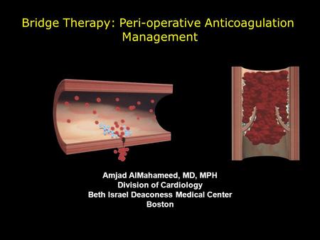 Bridge Therapy: Peri-operative Anticoagulation Management Amjad AlMahameed, MD, MPH Division of Cardiology Beth Israel Deaconess Medical Center Boston.