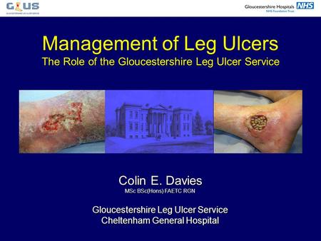Management of Leg Ulcers