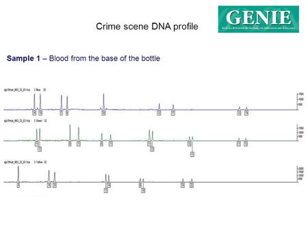 Crime scene DNA profile Sample 1 – Blood from the base of the bottle.