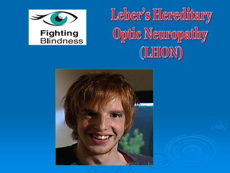 Leber’s Hereditary – inherited from mitochondrial DNA Optic – affects the eye Neuropathy – disease/abnormality of nervous system.