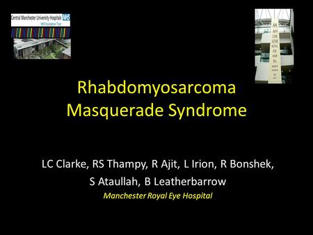Rhabdomyosarcoma Masquerade Syndrome LC Clarke, RS Thampy, R Ajit, L Irion, R Bonshek, S Ataullah, B Leatherbarrow Manchester Royal Eye Hospital.