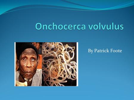 By Patrick Foote. Is a nematode. Causes Ochocerciasis or “river blindness” Nematode does not cause blindness, but its endosymbiont Wolbacia pipientis.