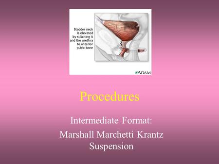 Intermediate Format: Marshall Marchetti Krantz Suspension