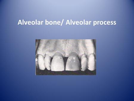 Alveolar bone/ Alveolar process