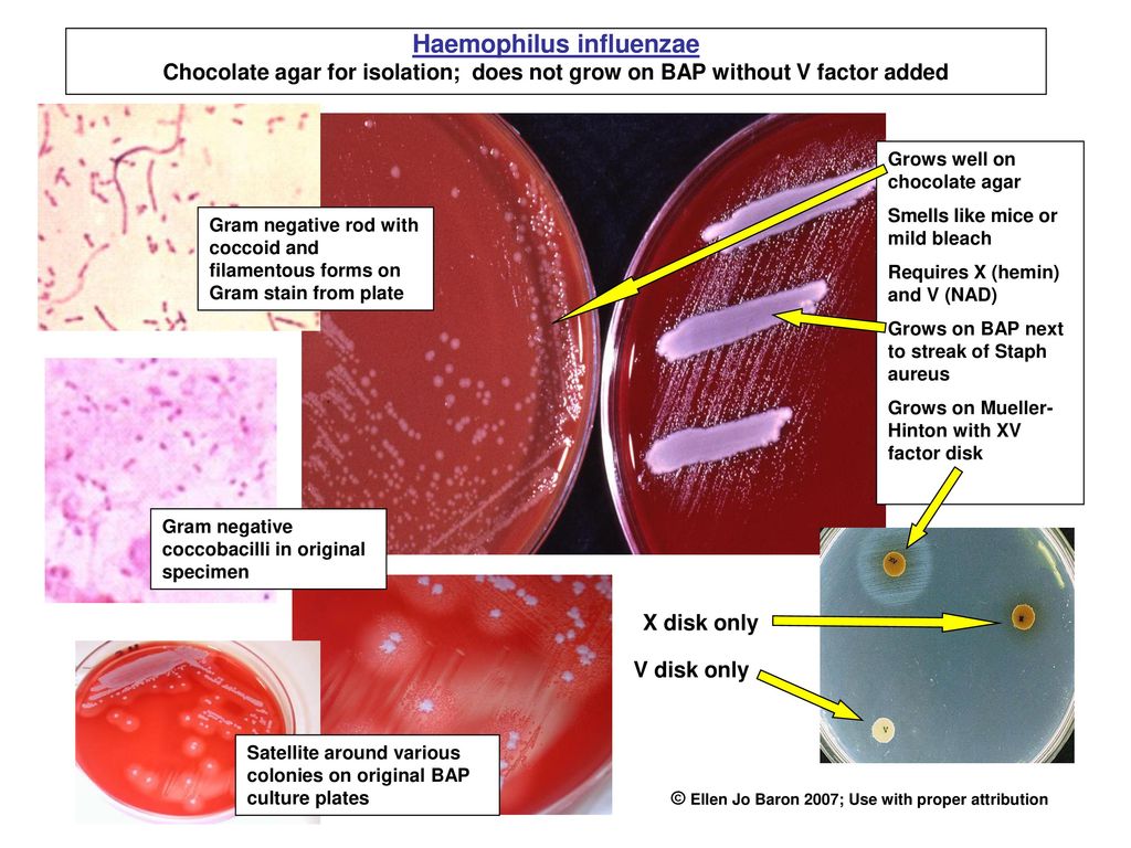 Haemophilus Influenzae Ppt Download