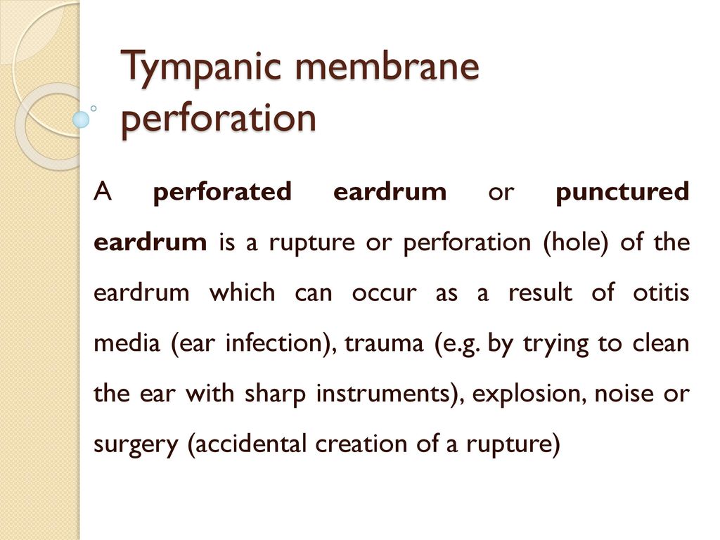 Tympanic membrane perforation - ppt download