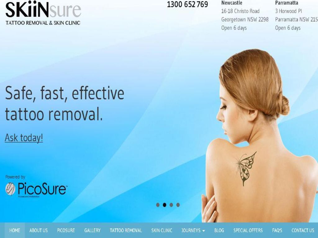 The Tattoo Removal Aftercare | Laser Tattoo Removal | sk:n clinics