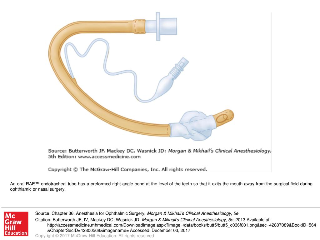 An oral RAE™ endotracheal tube has a preformed right-angle bend at the  level of the teeth so that it exits the mouth away from the surgical field  during. - ppt download