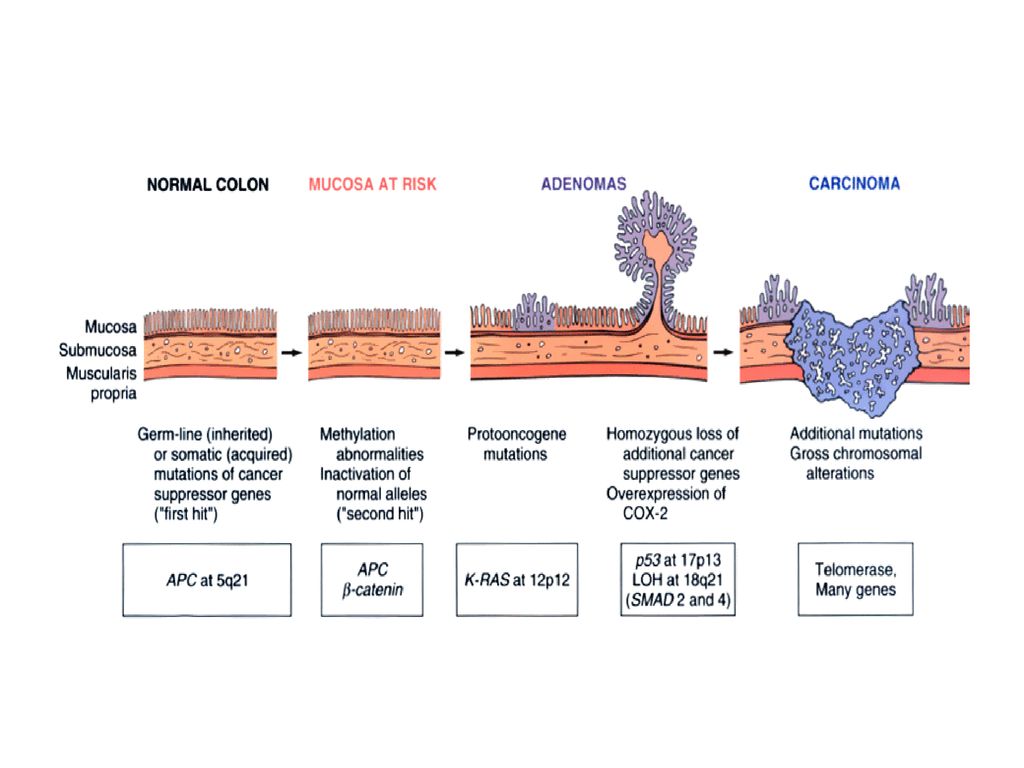 FAMILIAL ADENOMATOUS POLYPOSIS - ppt download