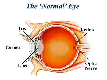 Lens Cornea Iris Optic Nerve Retina The ‘Normal’ Eye.