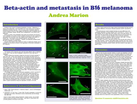 Beta-actin and metastasis in B 16 melanoma Introduction Incidence of skin cancer is increasing dramatically in humans. 1 Melanoma, a cancer of the melanocytes,