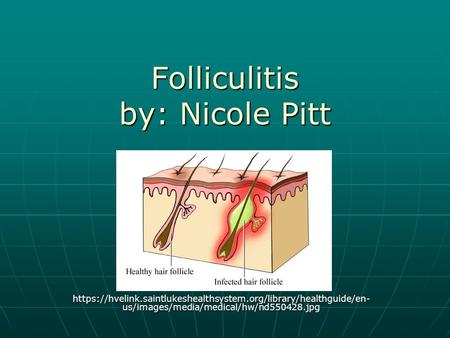 Folliculitis by: Nicole Pitt https://hvelink.saintlukeshealthsystem.org/library/healthguide/en- us/images/media/medical/hw/nd550428.jpg.