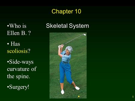 1 Chapter 10 Skeletal System Who is Ellen B. ? Has scoliosis? Side-ways curvature of the spine. Surgery!