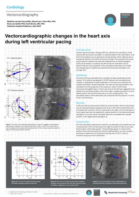 -159º ±180º -90º 0º 90º Pt 1 Lateral position Cardiology Vectorcardiography Madelon van den Heuvel BSc, Marcel van ’t Veer MSc, PhD, Berry van Gelder PhD,