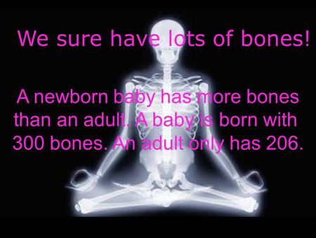 We sure have lots of bones! A newborn baby has more bones than an adult. A baby is born with 300 bones. An adult only has 206.