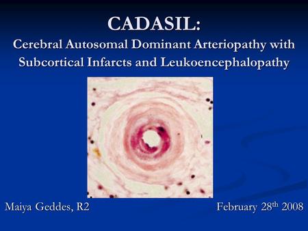 CADASIL: Cerebral Autosomal Dominant Arteriopathy with Subcortical Infarcts and Leukoencephalopathy Maiya Geddes, R2 February 28 th 2008.