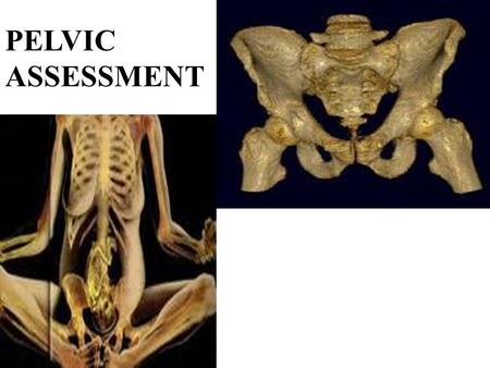 PELVIC ASSESSMENT. DEFINITION A pelvic assessment is a clinical assessment of the size and shape of the mothers pelvis by means of a vaginal examination.