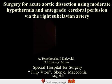 Cardiosurgery - Skopje Surgery for acute aortic dissection using moderate hypothermia and antegrade cerebral perfusion via the right subclavian artery.