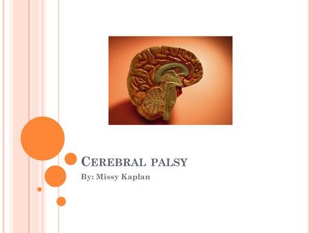 C EREBRAL PALSY By: Missy Kaplan. O UTLINE Introduction to Cerebral Palsy Epidemiology Etiology Treatment and Prevention Dental Management.