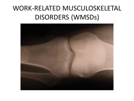 WORK-RELATED MUSCULOSKELETAL DISORDERS (WMSDs). FACTS!!!!! WMSDs are the leading cause of human suffering, loss of productivity and economic burden on.