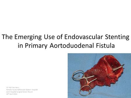The Emerging Use of Endovascular Stenting in Primary Aortoduodenal Fistula Good afternoon, today I will talk about “The Emerging Use of Endvoascular Stenting.