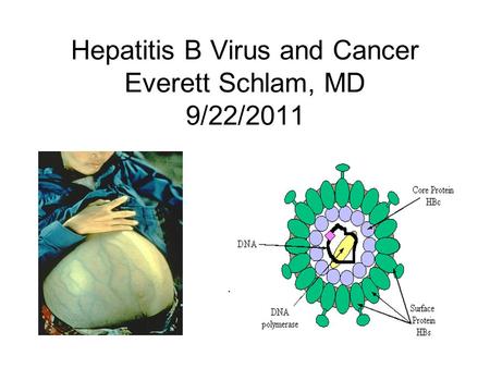 Hepatitis B Virus and Cancer Everett Schlam, MD 9/22/2011.