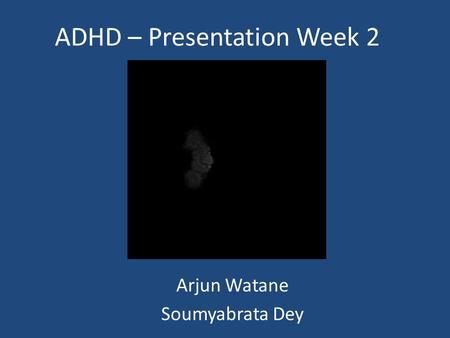 ADHD – Presentation Week 2 Arjun Watane Soumyabrata Dey.